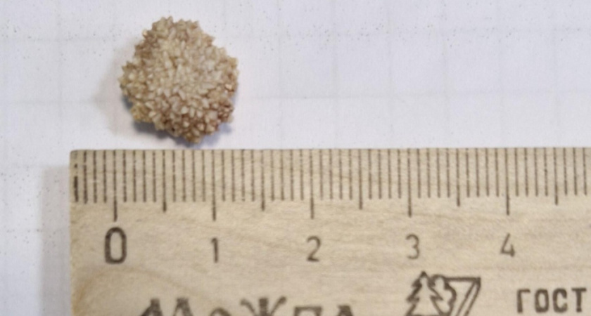 В Саратове ветеринары удалили мочевой камень 13-летней кошке