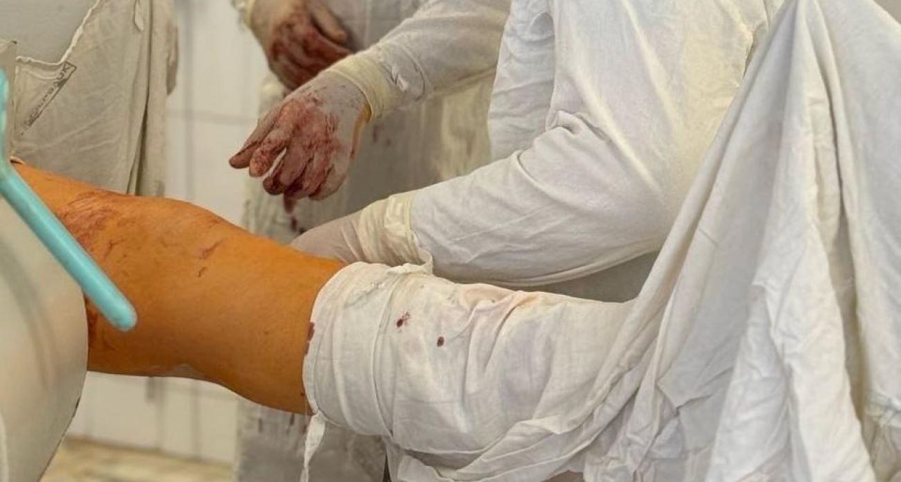 Главврачей обязали сообщать о пациентах в коме в течение часа: в Саратове узаконили изъятие органов