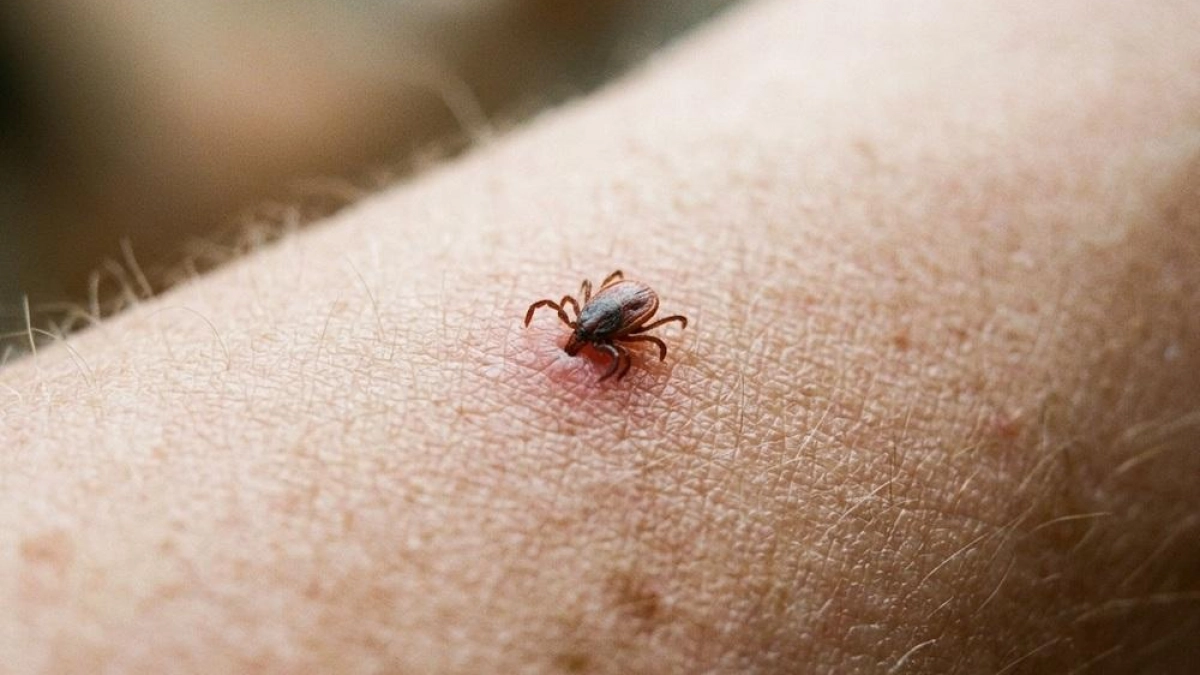 Клещи в Саратовской области проснулись раньше срока: уже 15 случаев боррелиоза